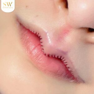 after_lips_review_08-300x300