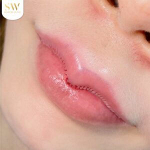 after_lips_review_09-300x300