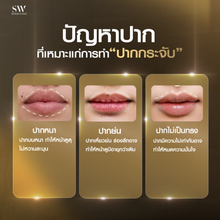 promotion-lip-surgery-ads-lip10