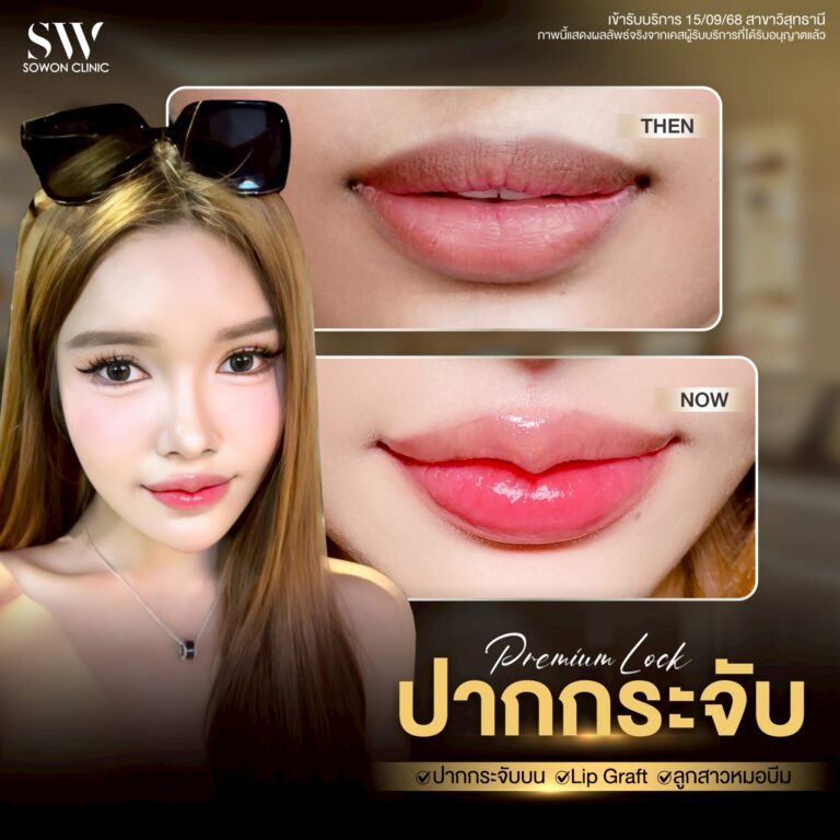 promotion-lip-surgery-ads-lip3w
