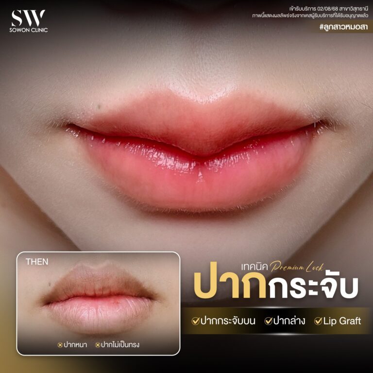 promotion-lip-surgery-ads-lip4