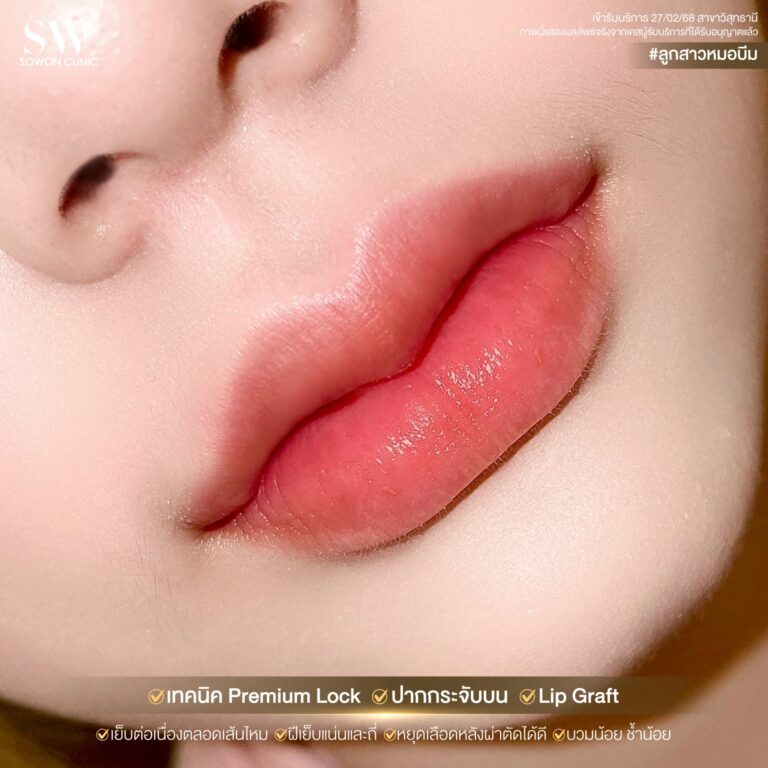 promotion-lip-surgery-ads-lip44