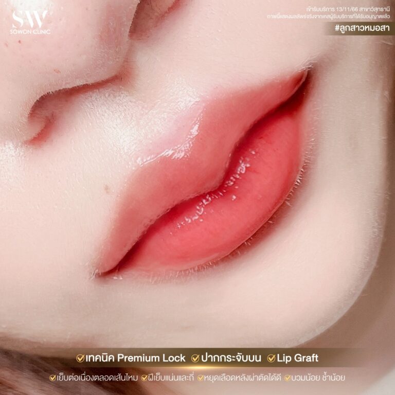 promotion-lip-surgery-ads-lip55