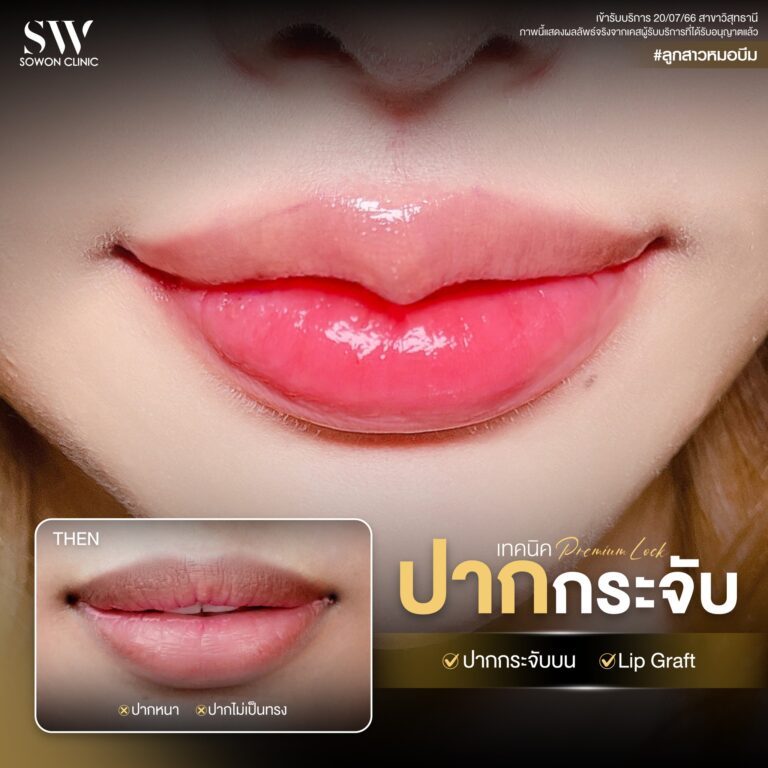 promotion-lip-surgery-ads-lip6