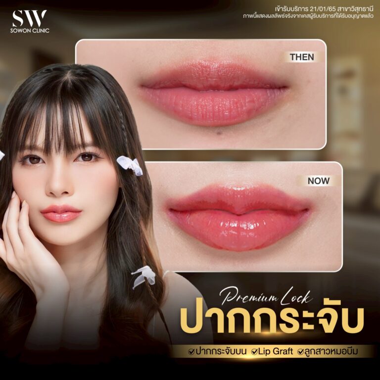 promotion-lip-surgery-ads-lip65