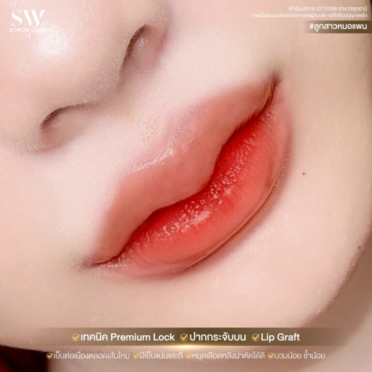 promotion-lip-surgery-ads-lip66
