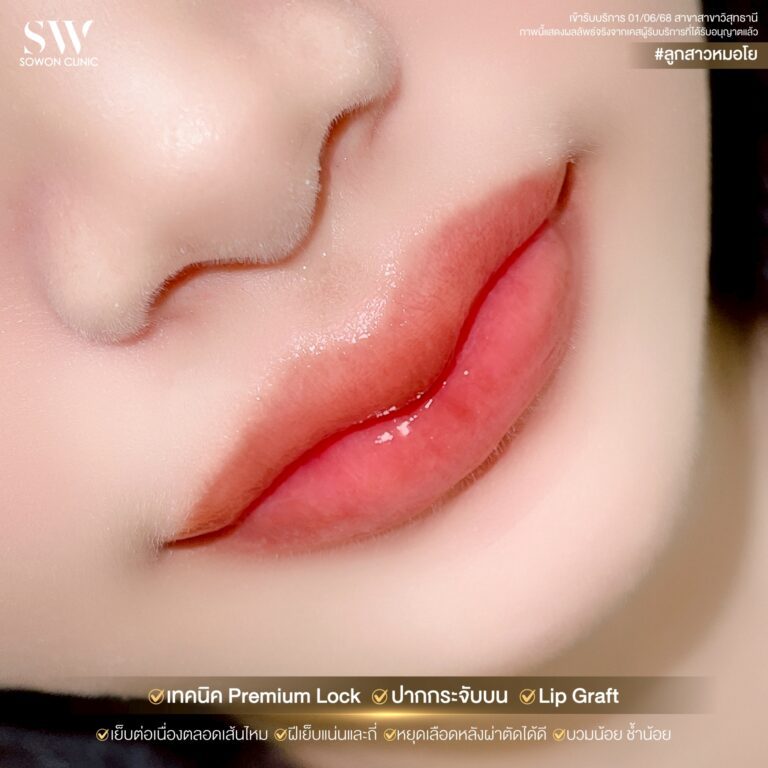 promotion-lip-surgery-ads-lip77
