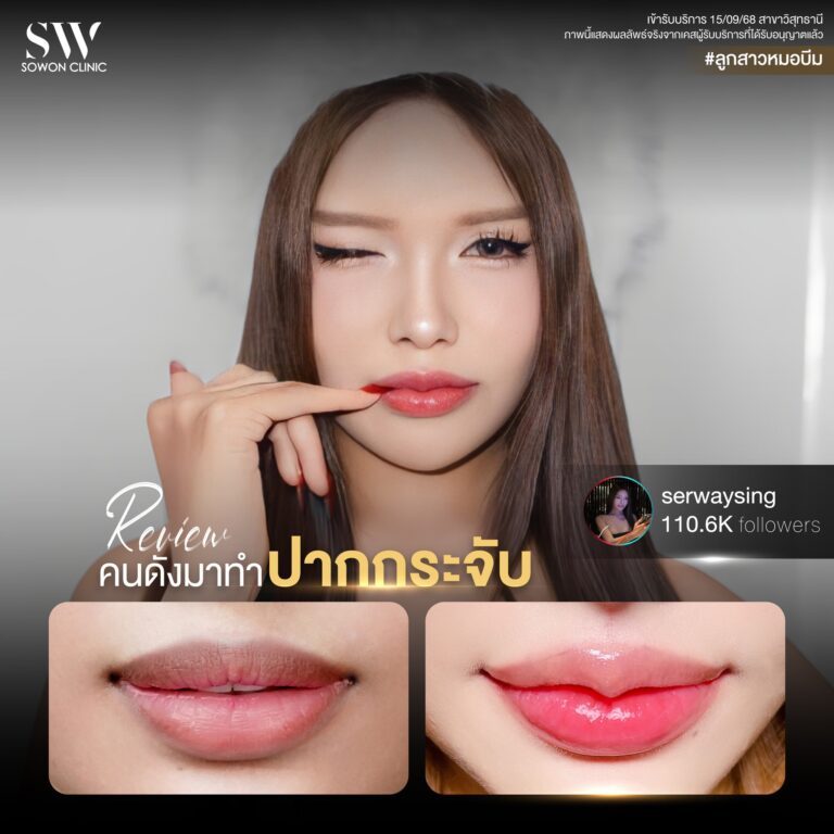 promotion-lip-surgery-ads-lipd
