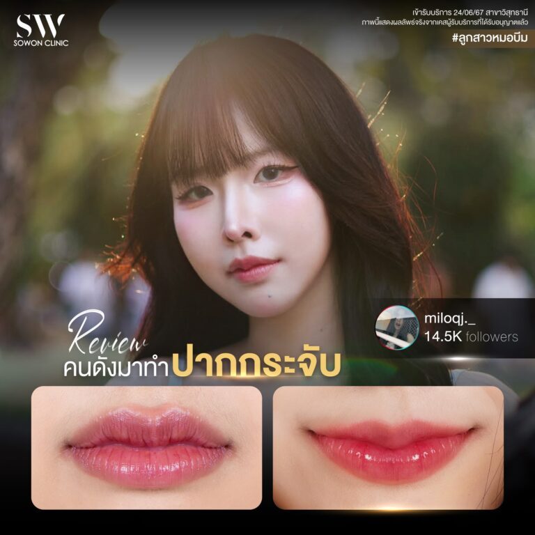 promotion-lip-surgery-ads-lipdfdf