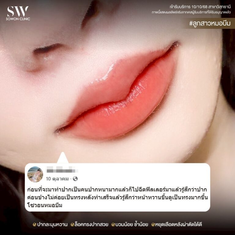 promotion-lip-surgery-ads-lipdff