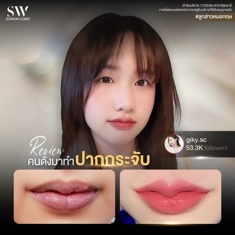 promotion-lip-surgery-ads-lipdff