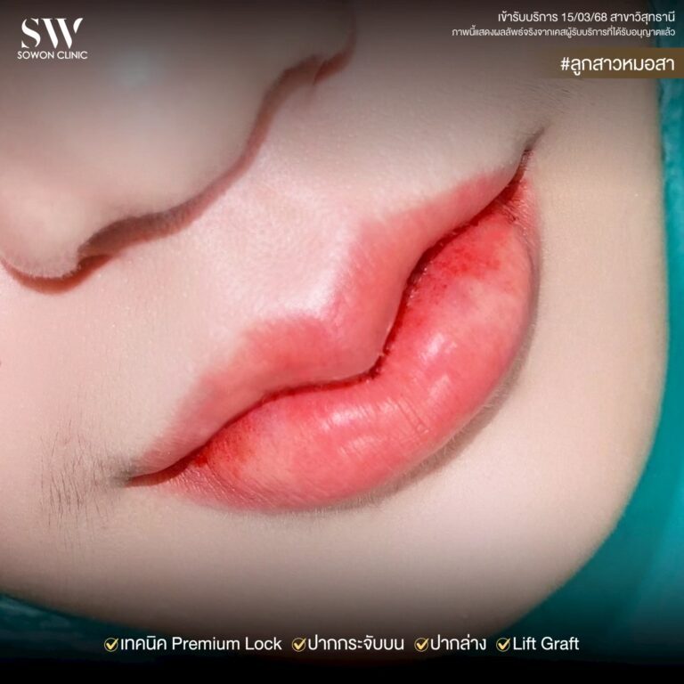 promotion-lip-surgery-ads-lipeer