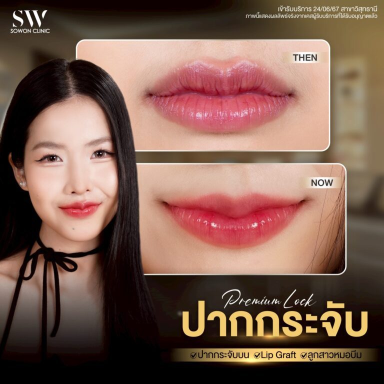 promotion-lip-surgery-ads-lipef