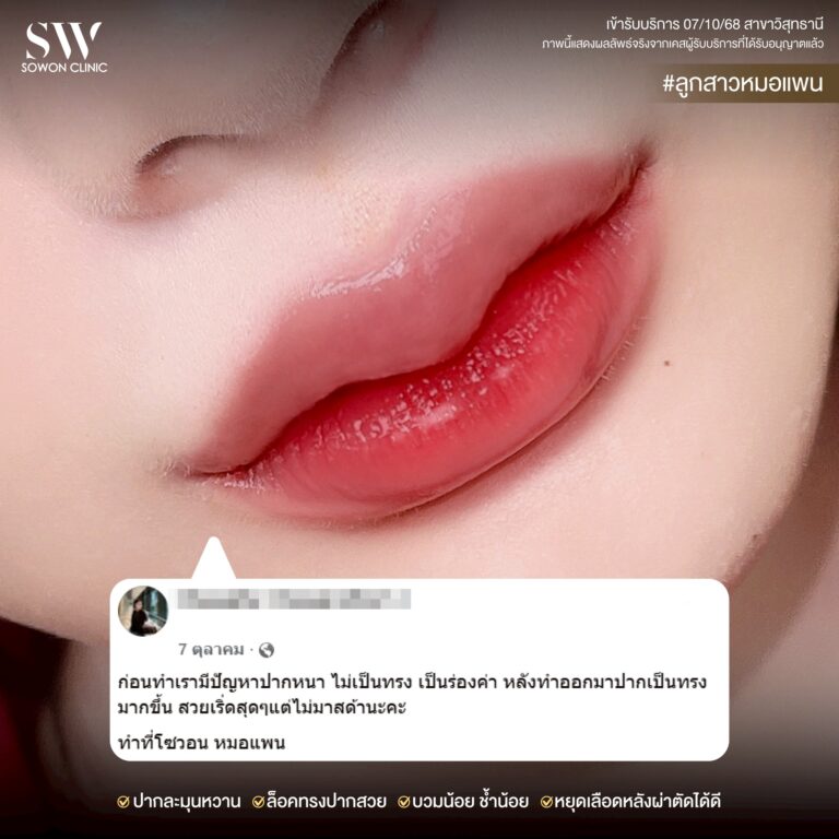 promotion-lip-surgery-ads-lipii