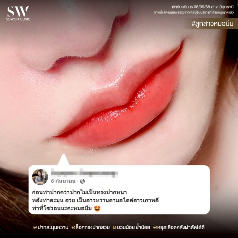 promotion-lip-surgery-ads-lipiii