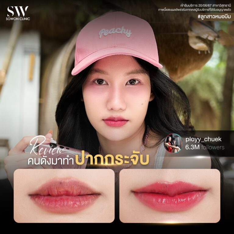 promotion-lip-surgery-ads-lipsadasfd