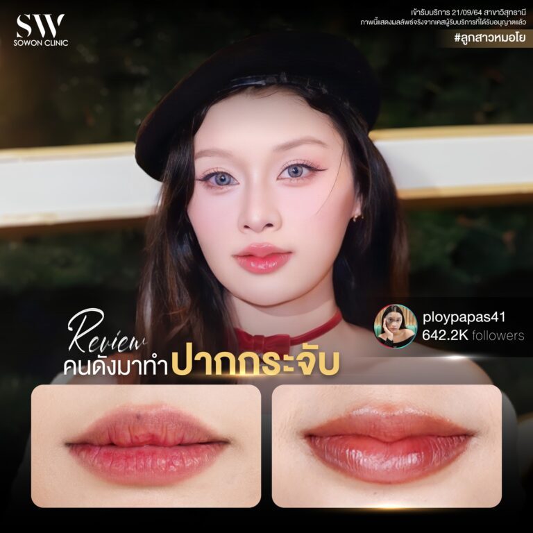 promotion-lip-surgery-ads-lipsaddasd