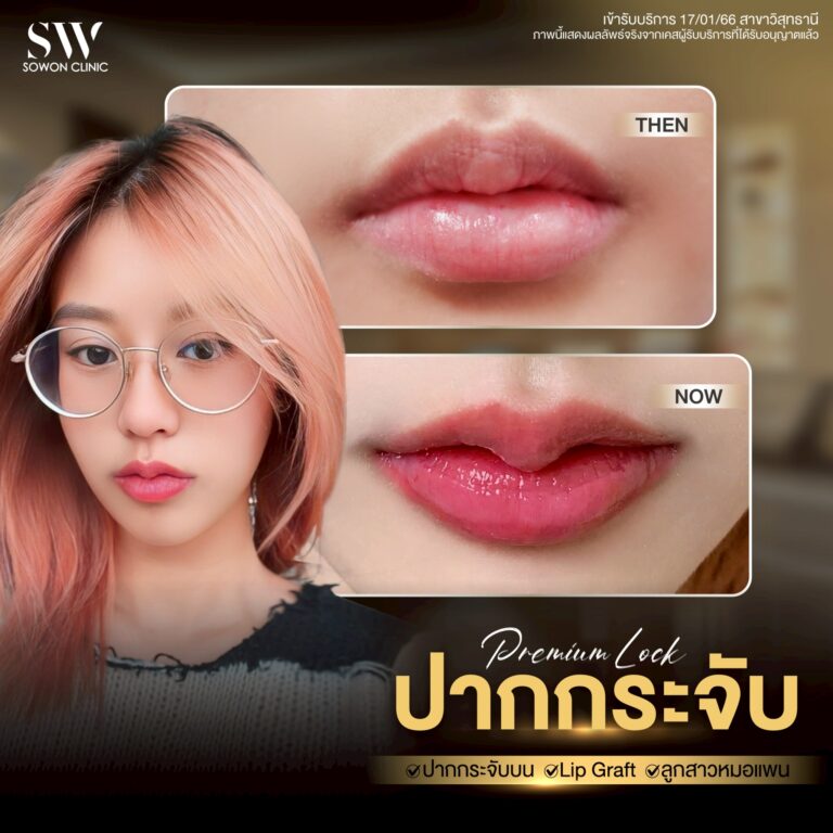 promotion-lip-surgery-ads-lipsd