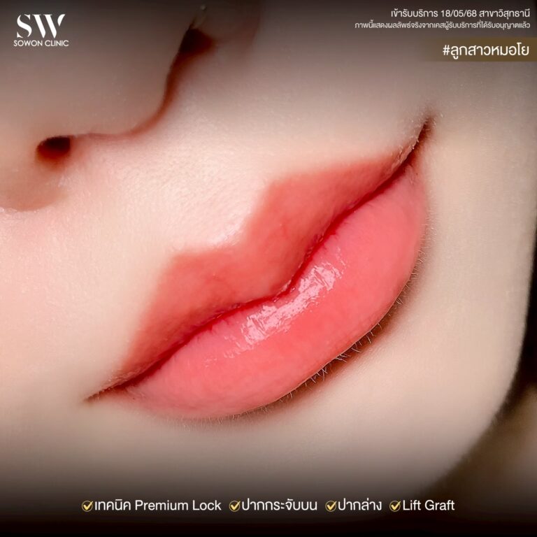 promotion-lip-surgery-ads-lipsdsd