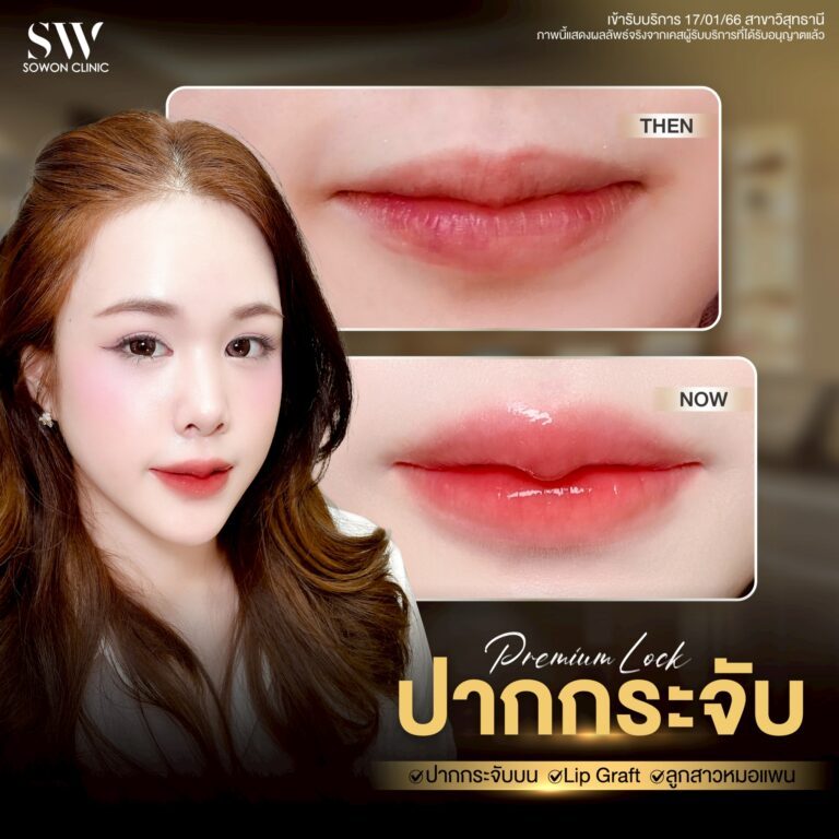 promotion-lip-surgery-ads-lipsfdf