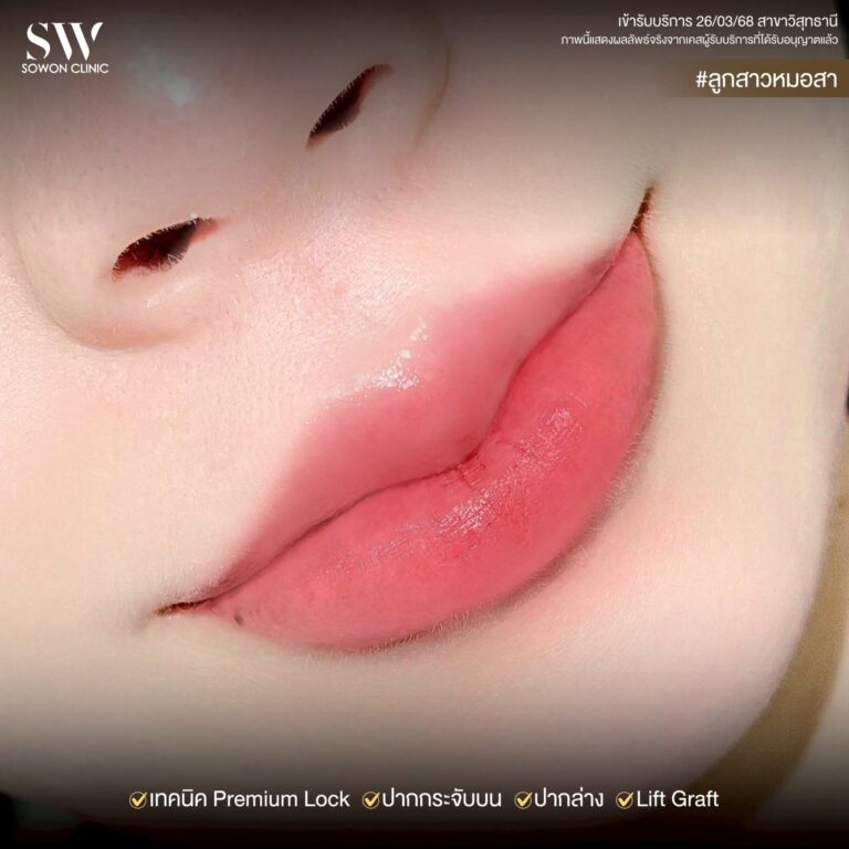 promotion-lip-surgery-ads-lipssa