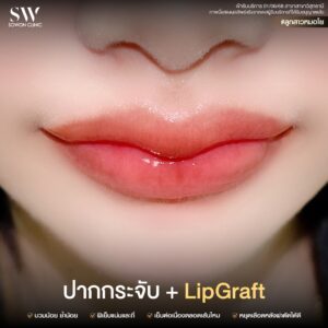 promotion-lip-surgery-ads-liptyy