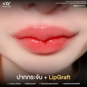 promotion-lip-surgery-ads-lipuuui