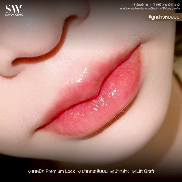 promotion-lip-surgery-ads-lipwewe
