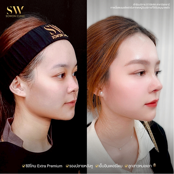 review-nose-x6