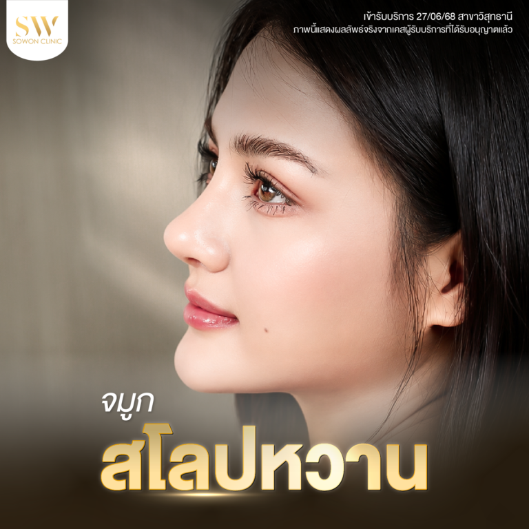 เบ3